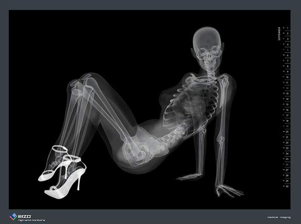 skeleton-x-ray-pin-up-calendar2.jpg
