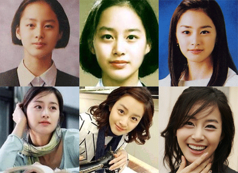 Kim Tae Hee Plastic Surgery Before and After Photos | Plastic Surgery