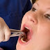 تسوس الأسنان يصيب 35% من سكان العالم