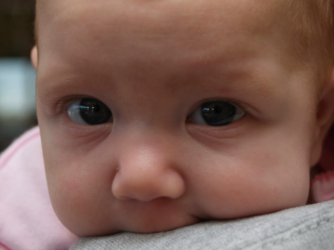 Lupus symptoms in your baby Brain Damage