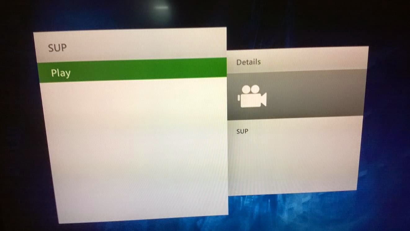 serviio xbox one serviio xbox one