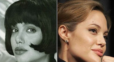 Angelina Jolie Plastic Surgery Before And After