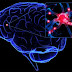 Τι κάνει τον ανθρώπινο εγκέφαλο ξεχωριστό? 