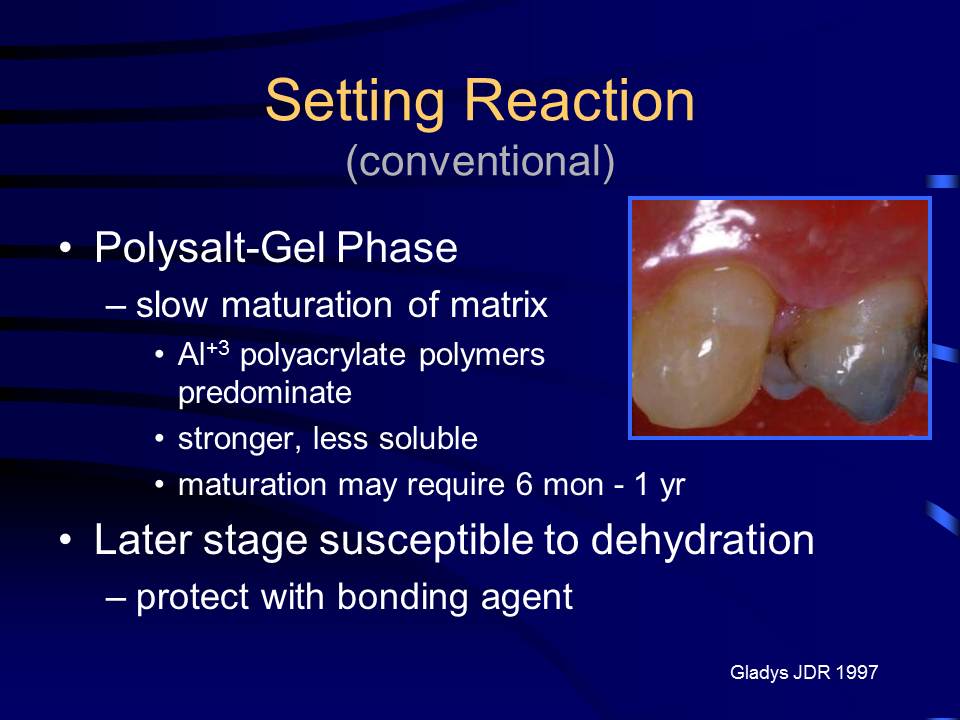 Dentistry GlassIonomers & Compomers