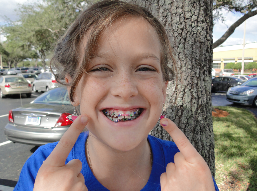 Fairfax Gallants CHLOE GETS BRACES!