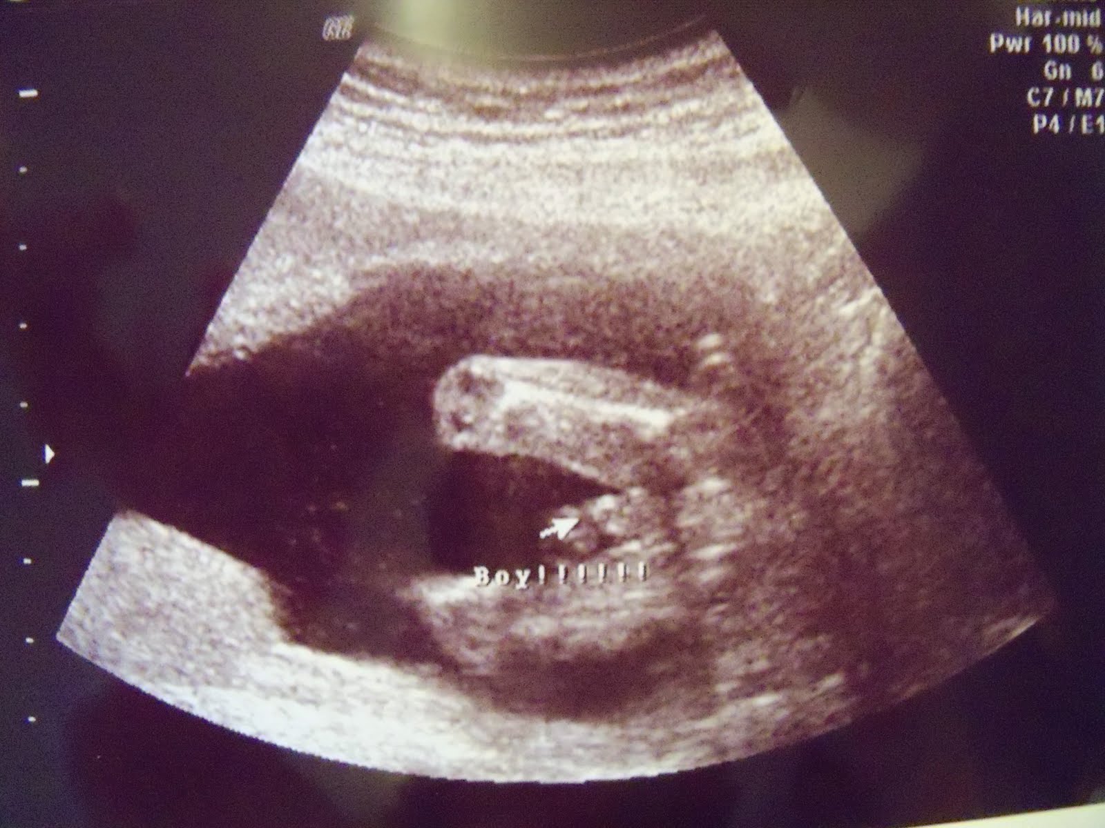 Josh, Danielle, Jamison, Bauer & Adalyn: It is a.......