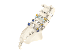 Apex Spine www.thespinemarketgroup.com