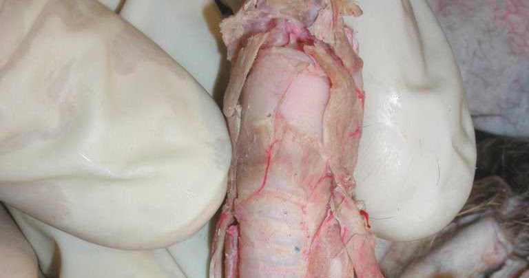 Anatomy And Physiology Of Esophagus.ppt ~ YOUNG DOCTORS' RESEARCH FORUM