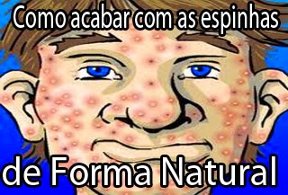 cura atraves de remedio natural para espinhas cura atraves de remedio natural para espinhas