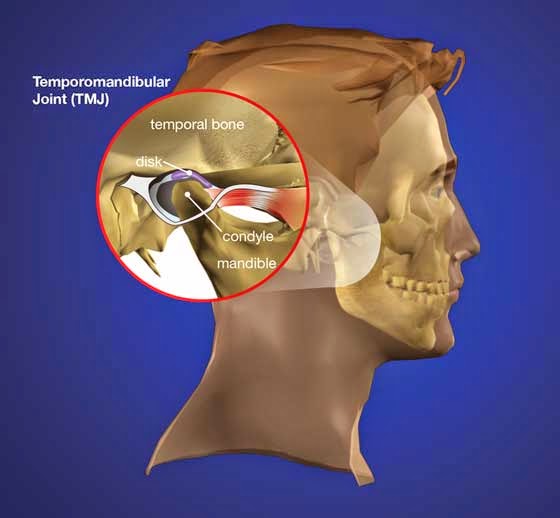 Temporomandibular Joint Dysfunction Temporomandibular Joint Dysfunction