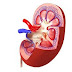 Diseases Of Kidney Cure Remedy Treatment