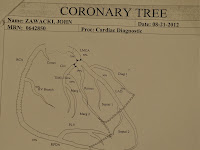 Coronary Artery Diagram Coronary Artery Diagram