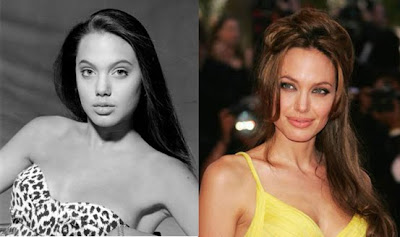 Angelina Jolie Plastic Surgery Before And After