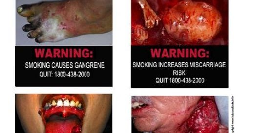 bad effects of smoking In fact, smoking accounts for 30 percent of all cancer deaths in the us learn exactly why smoking is so bad for the health, and why people should quit smoking damages nearly every organ in the. bad effects of smoking In fact, smoking accounts for 30 percent of all cancer deaths in the us learn exactly why smoking is so bad for the health, and why people should quit smoking damages nearly every organ in the.