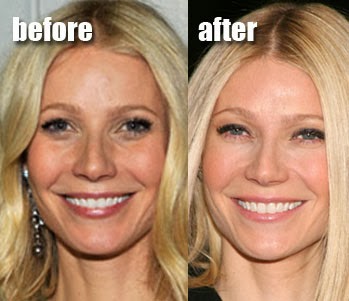 has gwyneth paltrow had breast surgery Has gwyneth paltrow had breast surgery