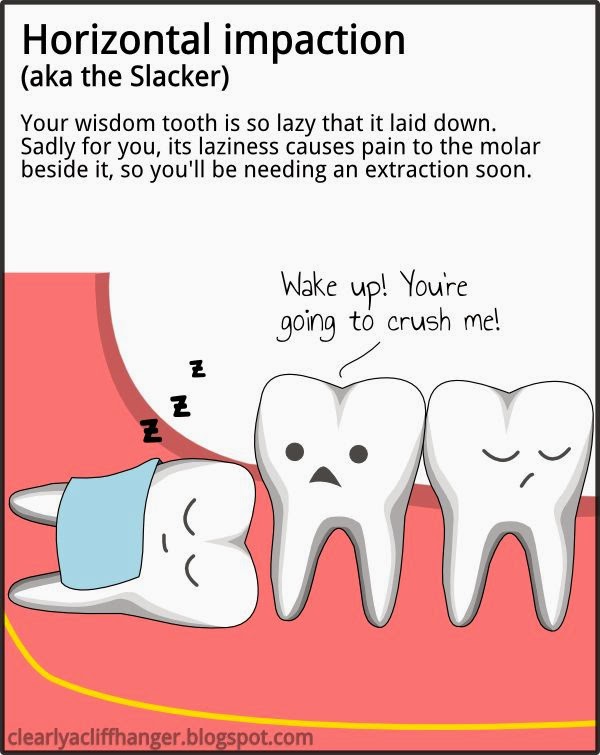 The Dentist Confirmed My Guess And Told Me That Reason Why Gum Will Become Swollen Was Because Wisdom Tooth Grew Horizontally Ie Horizontal