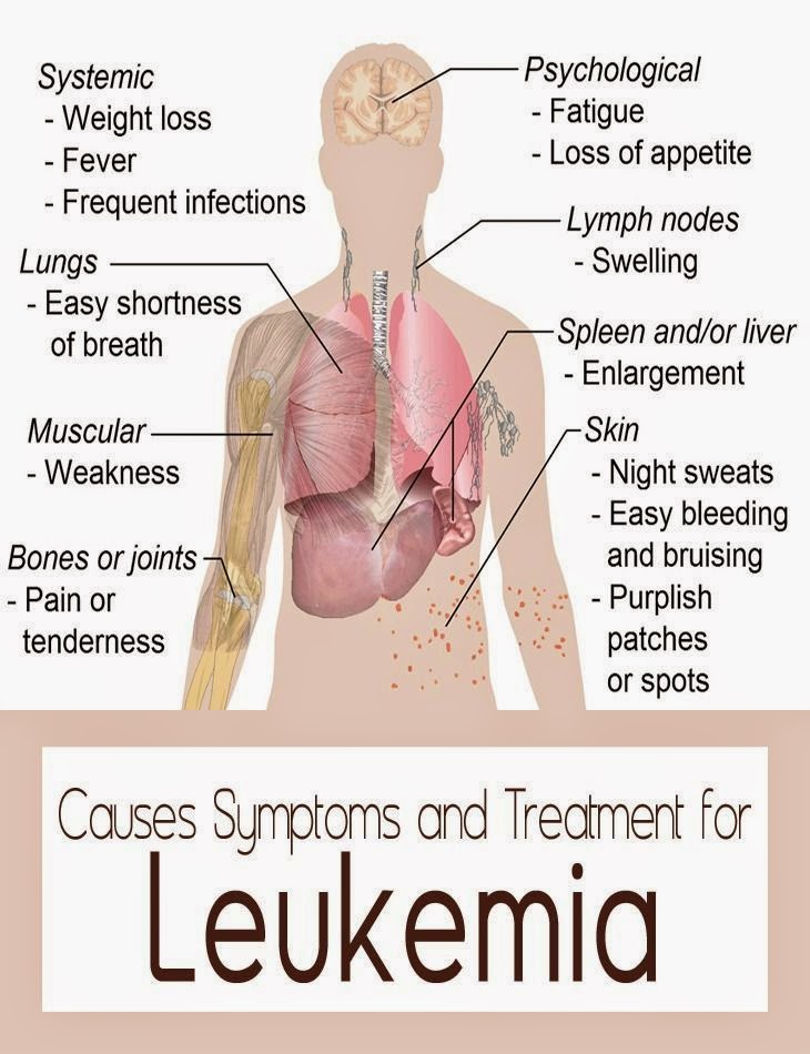 chronic lymphatic leukemia essay chronic lymphatic leukemia essay