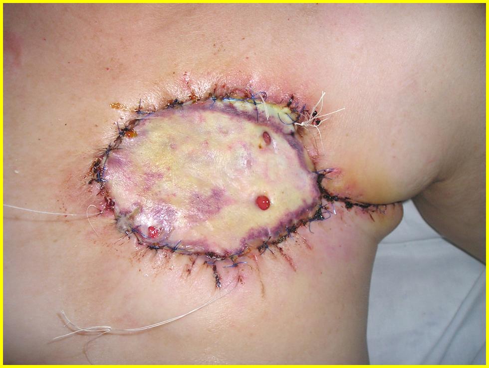 TIPOS DE CANCER IMAGENES tipos de cancer imagenes: