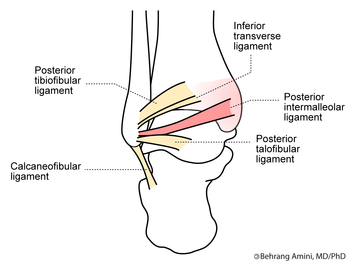 Spiral Fracture Fibula Posterior Intermalleolar Ligament-4.bp.blogspot.com