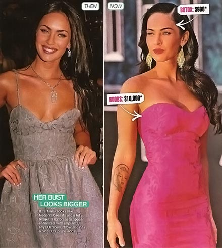 Plastic Surgery    on Megan Fox Plastic Surgery Before And After