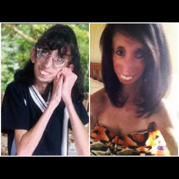 Photos of lizzie velasquez, the world'S ugliest who can't gain we...