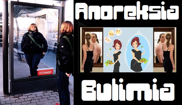 Tanda-Tanda Anoreksia Dan Bulimia Tanda-Tanda Anoreksia Dan Bulimia