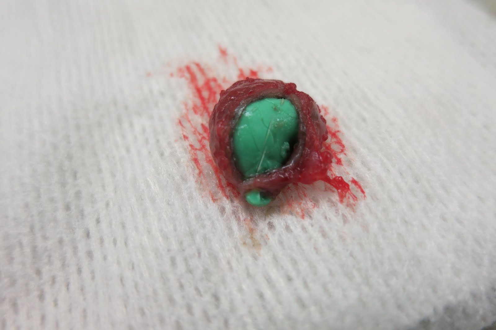 Infected anal sacs - Step siblings Infected anal sacs
