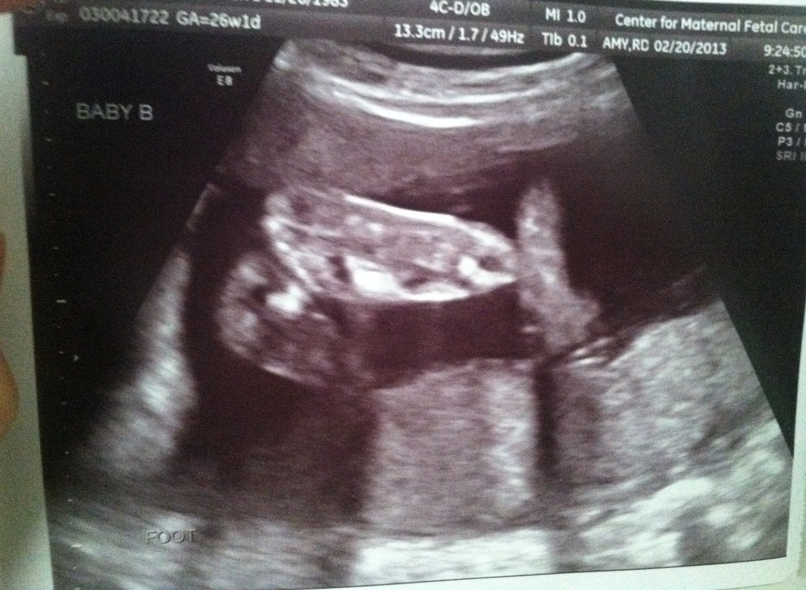 LuvLaughPray 26 Weeks Ultrasound / Pics / H2O Like a Pro