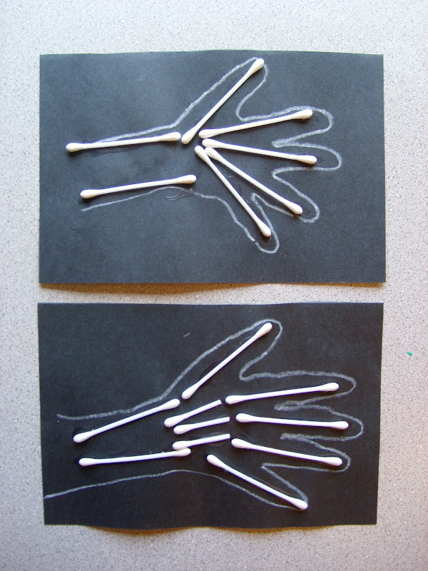 Chipman's Corner Preschool Bone XRays