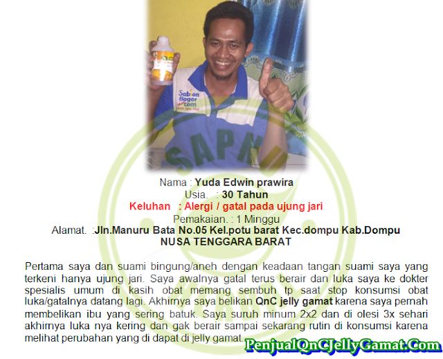 Cara Menyembuhkan Dermatitis Di Wajah Terampuh , TERBUKTI Mujarab!! Cara Menyembuhkan Dermatitis Di Wajah Terampuh , TERBUKTI Mujarab!!