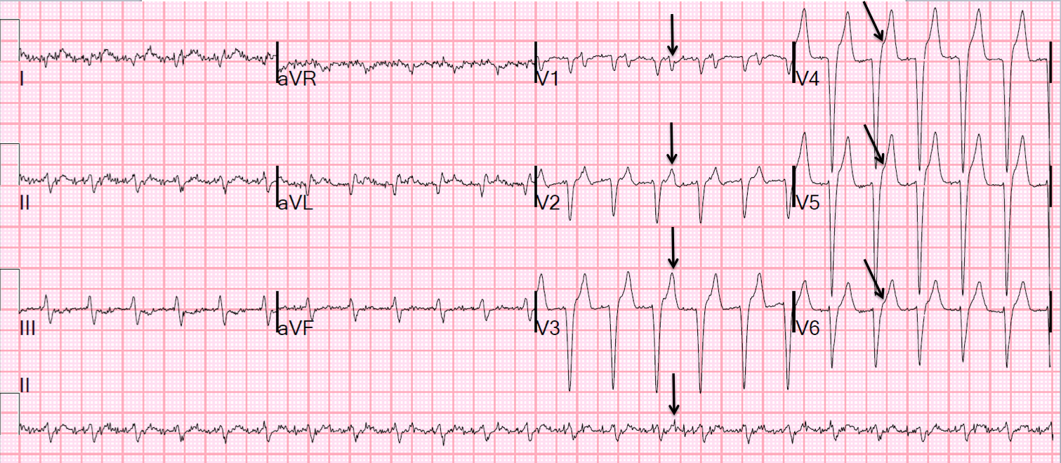 ecg notes shirley jones pdf