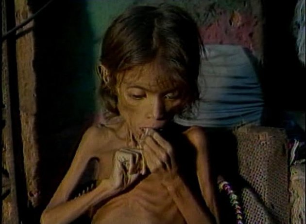 Resultado de imagem para fome nordeste anos 90