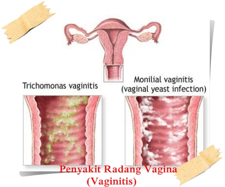 pain underneath my left breast listen to lets talk about sex baby