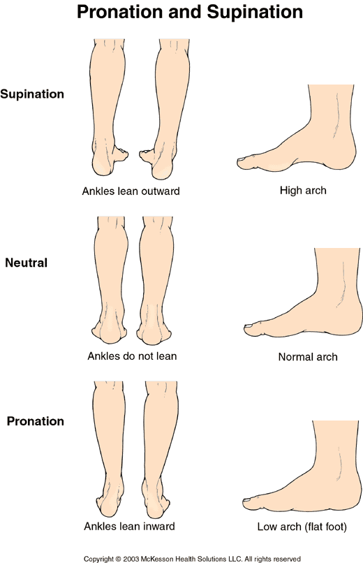high arch supination running shoes