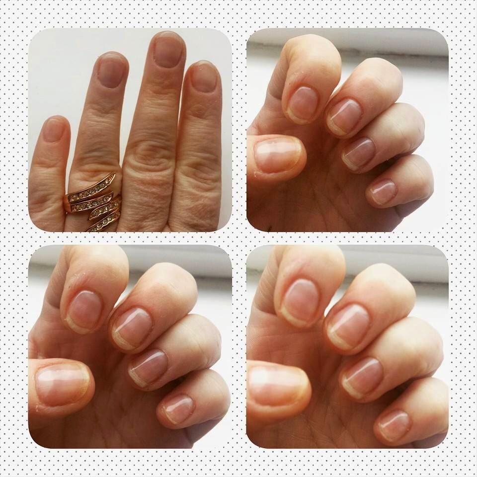 Neostrata Nail Conditioning Solution Rachsbeautique