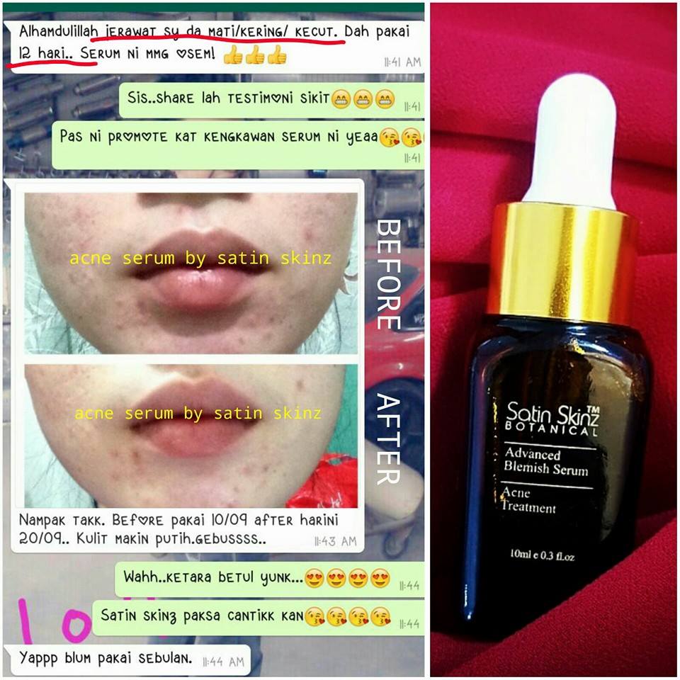 satin skinz advanced blemish serum kiosk satin skinz advanced blemish serum kiosk