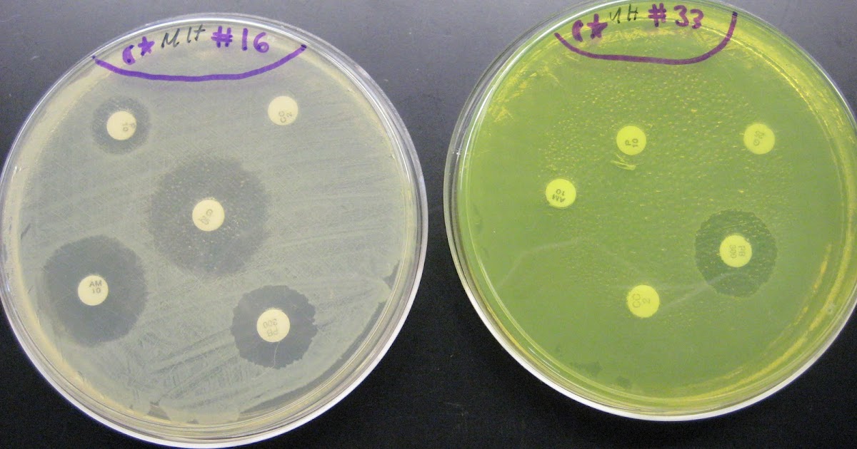 DVC Microbiology 146 Fall 11 (Gard) Lab 32 Antibiotic Sensitivity