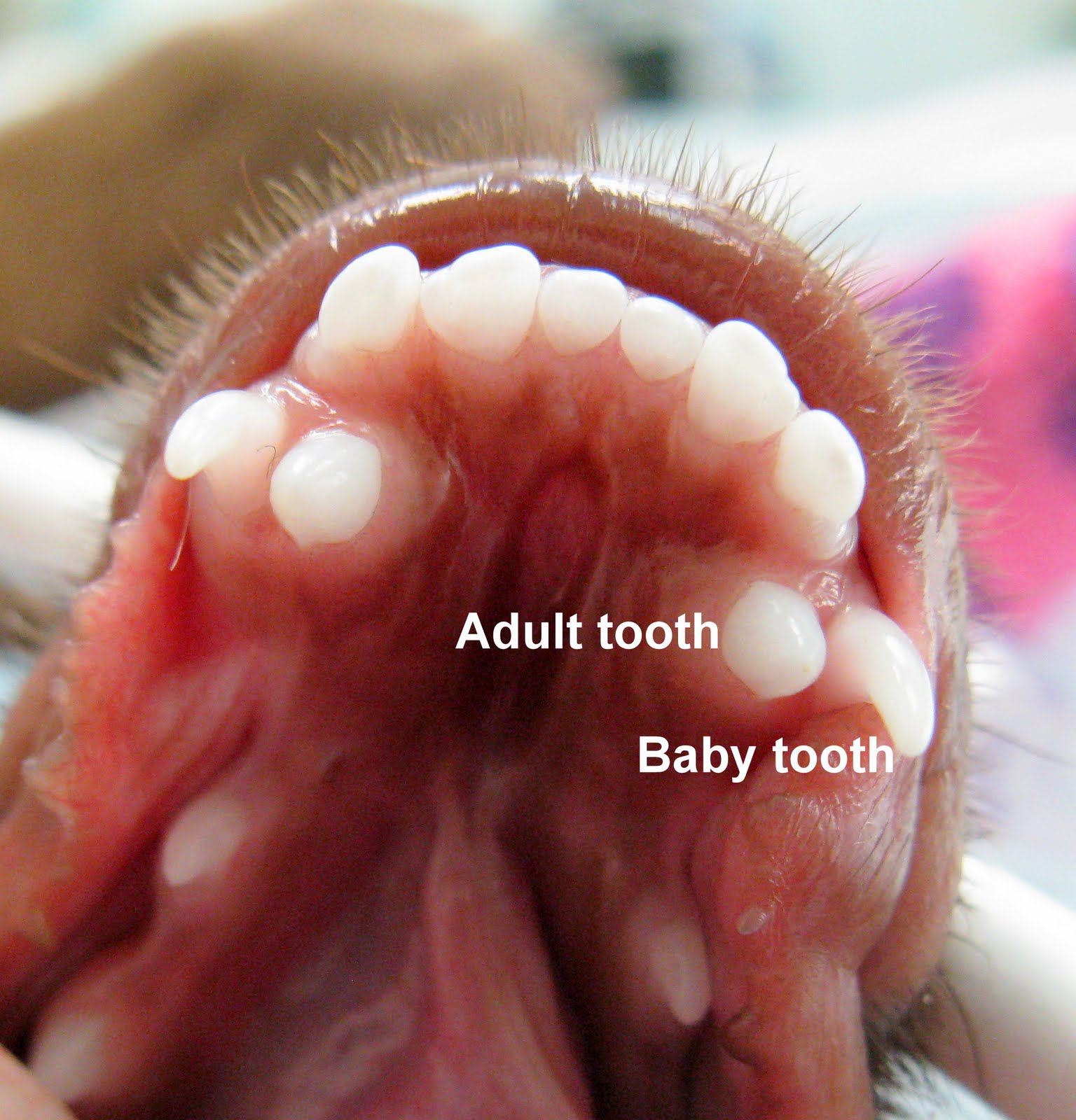 Baby teeth in adults strength