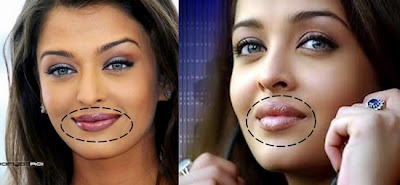 Aishwarya Rai Lip Surgery -Before and After |Alia Bhatt