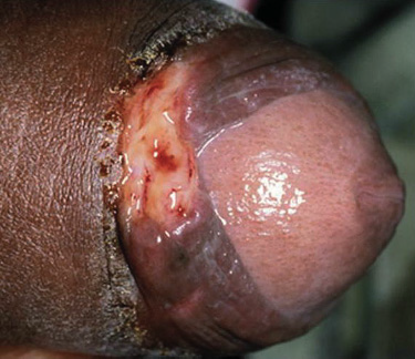 hot sexy naked pics of blondes cummed on holes stds penis