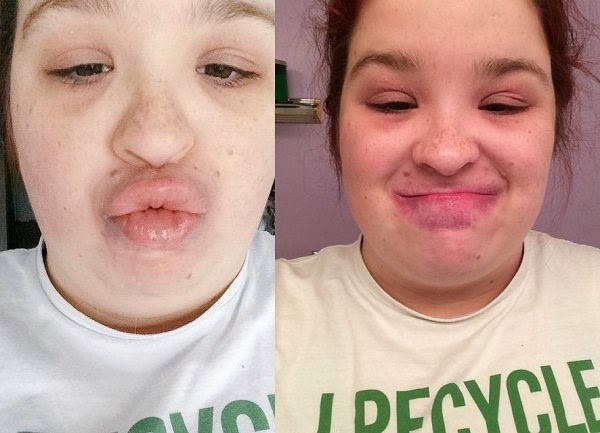 Kylie Jenner Challenge on Twitter Results of Latest Trend of Internet