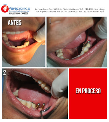 http://www.dentalperezyance.com/
