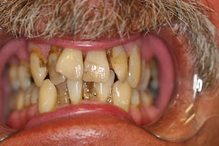 Golpa-DentalImplantCenter.com