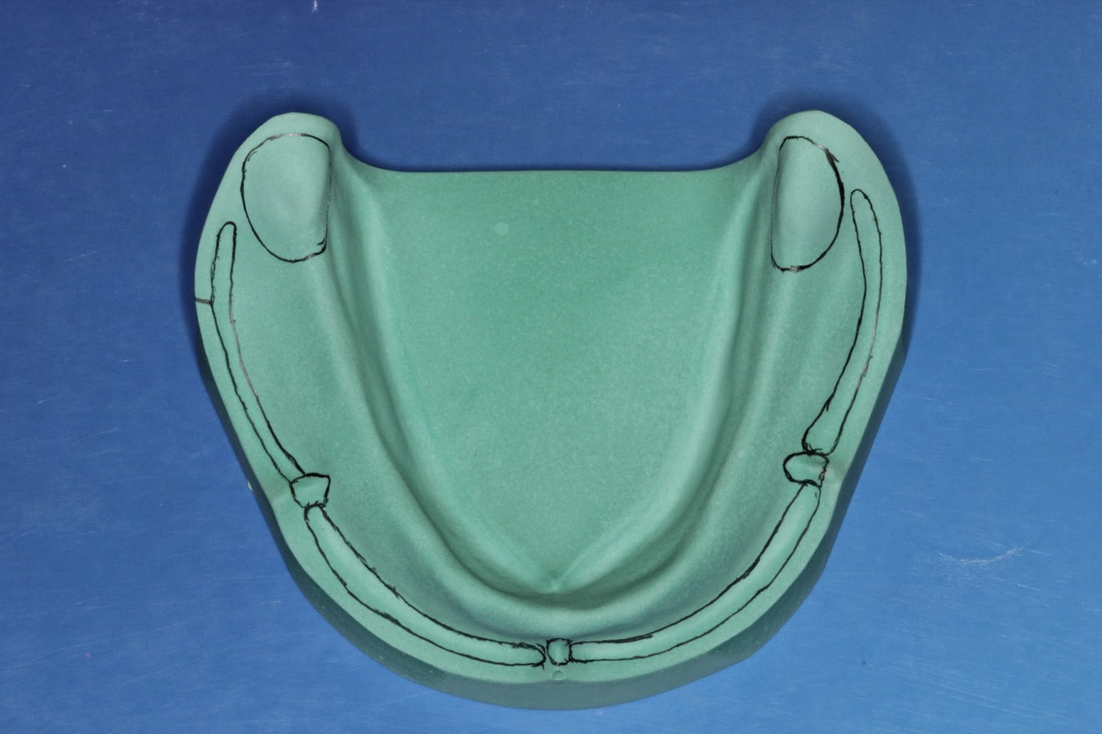 Step by step Guide for Understanding the Prosthodontics Anatomical