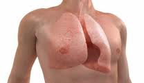 lung cancer treatment for lung cancer
