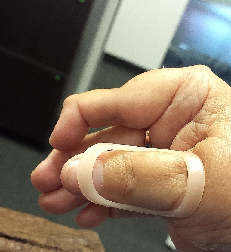Ring Splints for Rheumatoid Arthritis