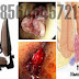 Obat Generik Wasir thumbnail