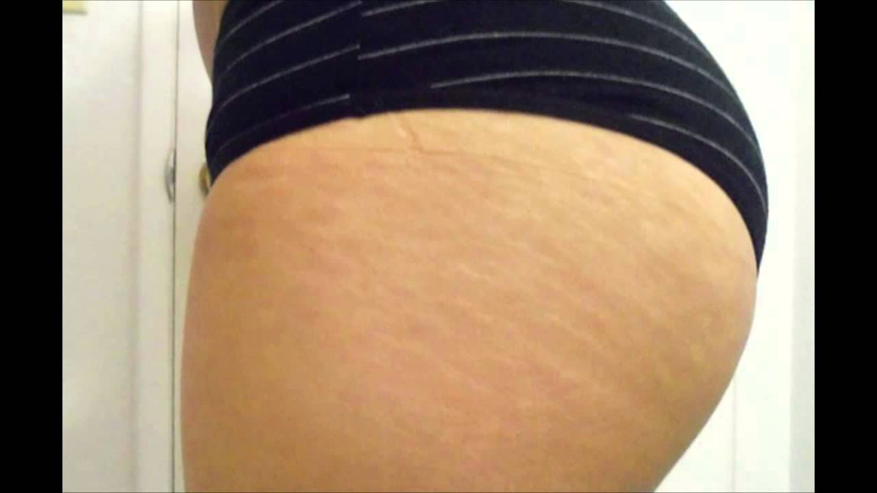 woman iran anus ass how to stretch ass