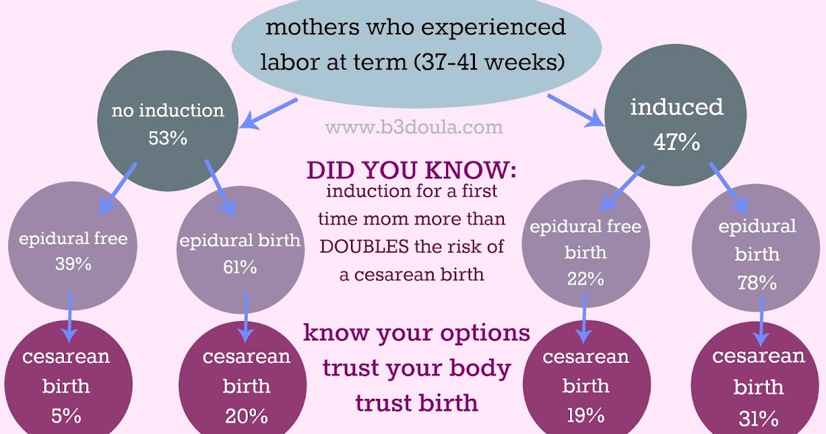 Beautiful Beginnings Inducing Labor The Pros And Cons