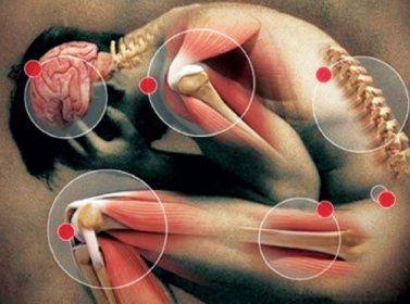 الام المزمنة